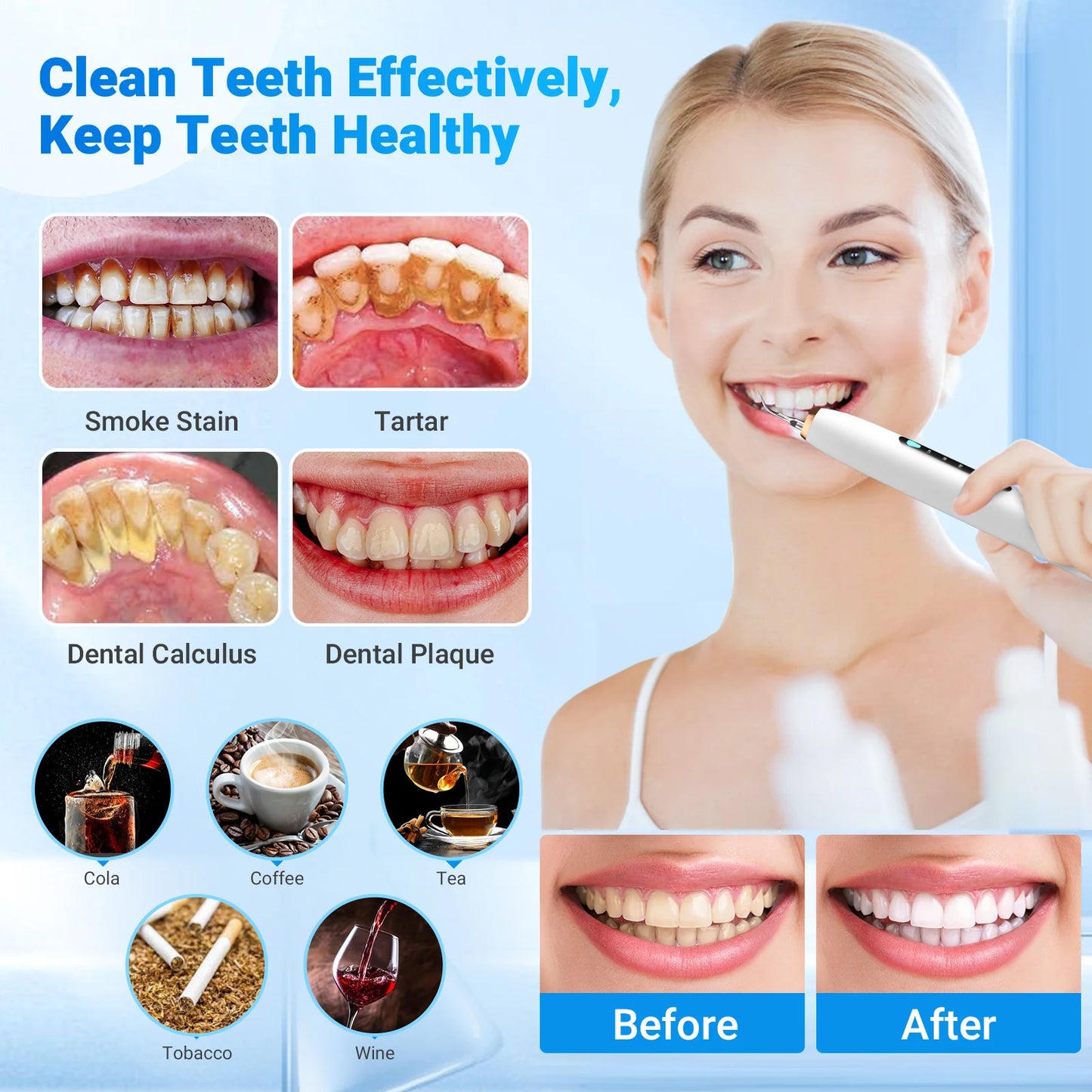 Smart Home Dental Ultrasonic Cleaning Device